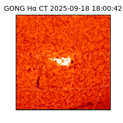 gong - 2025-09-18T18:00:42