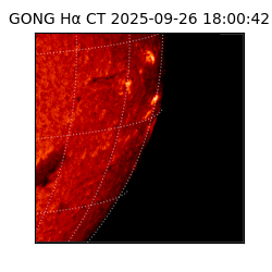gong - 2025-09-26T18:00:42