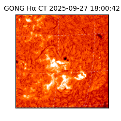 gong - 2025-09-27T18:00:42