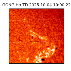 gong - 2025-10-04T10:00:22