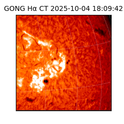 gong - 2025-10-04T18:09:42