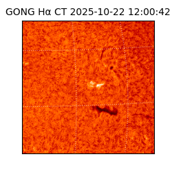 gong - 2025-10-22T12:00:42