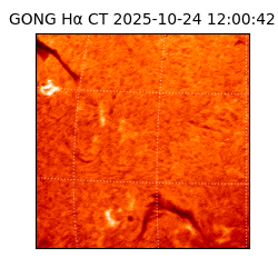 gong - 2025-10-24T12:00:42