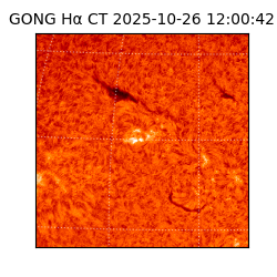 gong - 2025-10-26T12:00:42