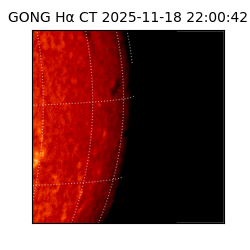 gong - 2025-11-18T22:00:42