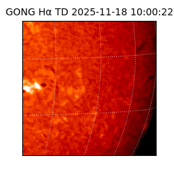 gong - 2025-11-18T10:00:22