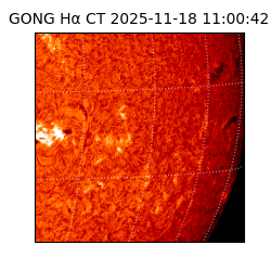 gong - 2025-11-18T11:00:42