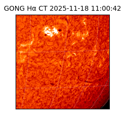 gong - 2025-11-18T11:00:42