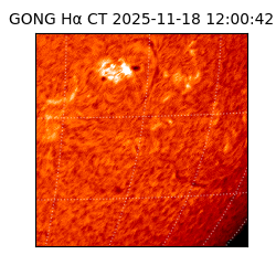 gong - 2025-11-18T12:00:42