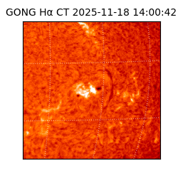 gong - 2025-11-18T14:00:42