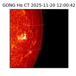 gong - 2025-11-20T12:00:42