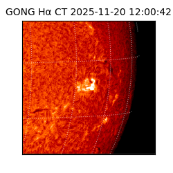 gong - 2025-11-20T12:00:42