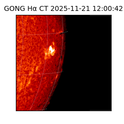 gong - 2025-11-21T12:00:42