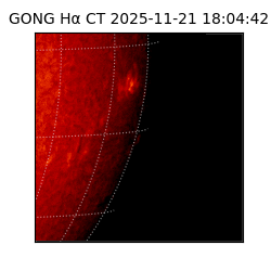 gong - 2025-11-21T18:04:42