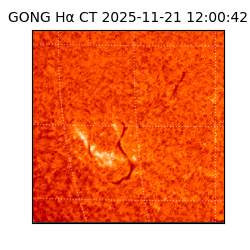 gong - 2025-11-21T12:00:42