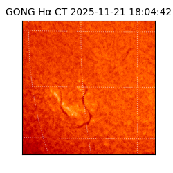 gong - 2025-11-21T18:04:42