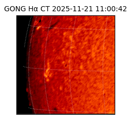 gong - 2025-11-21T11:00:42