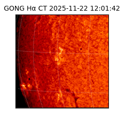 gong - 2025-11-22T12:01:42