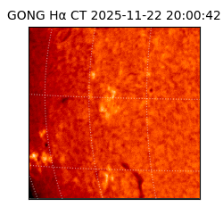 gong - 2025-11-22T20:00:42