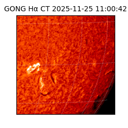 gong - 2025-11-25T11:00:42