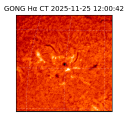 gong - 2025-11-25T12:00:42