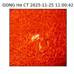 gong - 2025-11-25T11:00:42