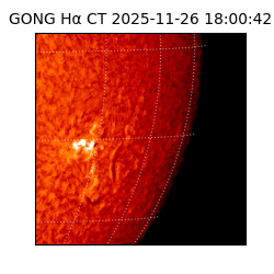 gong - 2025-11-26T18:00:42
