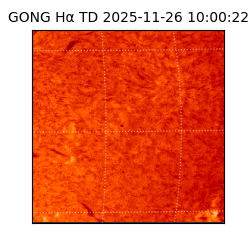 gong - 2025-11-26T10:00:22