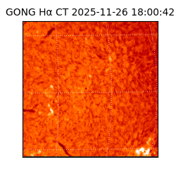 gong - 2025-11-26T18:00:42