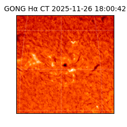 gong - 2025-11-26T18:00:42