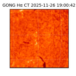 gong - 2025-11-26T19:00:42