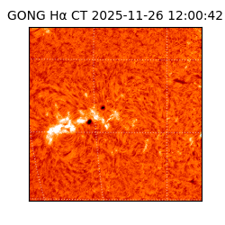 gong - 2025-11-26T12:00:42