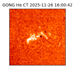 gong - 2025-11-26T16:00:42