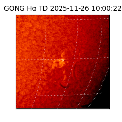 gong - 2025-11-26T10:00:22