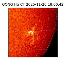 gong - 2025-11-26T18:00:42