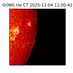 gong - 2025-12-04T11:00:42