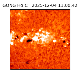 gong - 2025-12-04T11:00:42