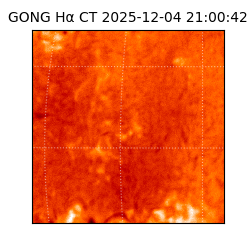 gong - 2025-12-04T21:00:42