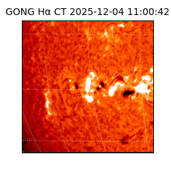 gong - 2025-12-04T11:00:42