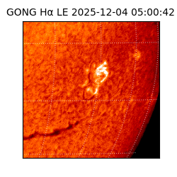 gong - 2025-12-04T05:00:42