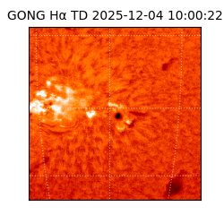 gong - 2025-12-04T10:00:22