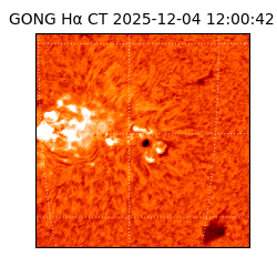 gong - 2025-12-04T12:00:42