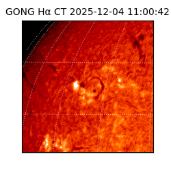 gong - 2025-12-04T11:00:42