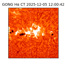 gong - 2025-12-05T12:00:42
