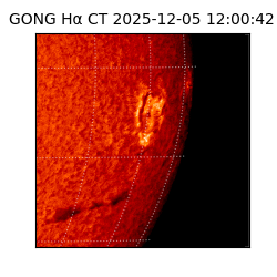 gong - 2025-12-05T12:00:42
