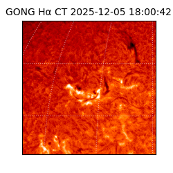 gong - 2025-12-05T18:00:42