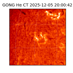 gong - 2025-12-05T20:00:42
