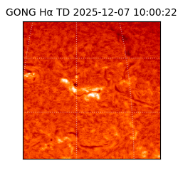 gong - 2025-12-07T10:00:22