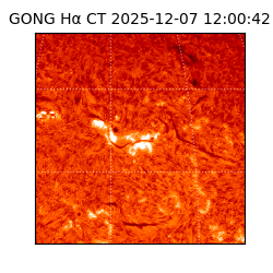 gong - 2025-12-07T12:00:42