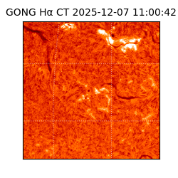 gong - 2025-12-07T11:00:42